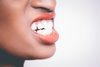 Teeth Grinding: Why we do it and what can be done to prevent it