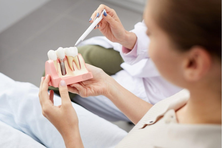 Restoring Your Smile: Dental Implants vs Dentures