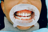 The untold dangers of gum disease